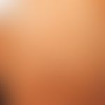 Abt-Letterer-Siwe-Krankheit:&nbsp;akute, disseminierte&nbsp;Langerhans-Zell-Histiozytose: Detaila...