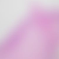 Stachelartige Hyperkeratosen bei Multiplem Myelom: Abb. enommen aus: Leerunyakul K et al. (2019)

