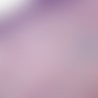 Erythema migrans arciforme et palpabile:&nbsp;unspezifische superfizielle perivaskuläre Dermatiti...