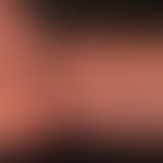 Hodgkin-Lymphom, Hautveränderungen:&nbsp;Mollusca contagiosa, disseminierte Auftreten&nbsp; bei H...