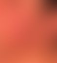 Teleangiektasie. Netzförmig verzweigte, unregelmäßige kapilläre Gefäßerweiterungen im Wangenberei...
