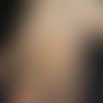 Hand-Fuß-Mund-Krankheit: Junge, 10 Jahre. Befund seit 2 Tagen rasch aufgeschossen. Befall Handflä...