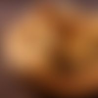 Trockenfeigen sind für Birkenpollenallergiker verträglich.&nbsp;
