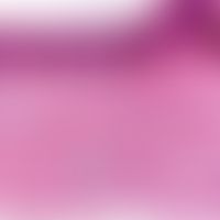 Pityriasis rotunda:&nbsp;unspezifisches Bild, mäßige Ortho- und Parakeratose, hyperpigmentiertes ...