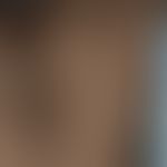 Hypomelanose progressive makulöse: multiple, unscharf begrenzte verwaschene grau-weißliche Flecke...