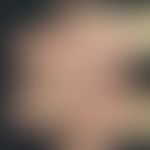 SAPHO-Syndrom: dermatologisches Teilsymptom mit ausgeprägter Pustulosis palmaris.&nbsp;&nbsp;Abb....