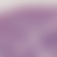 Amikrobielle intertriginöse Pustulose: suppurative Dermatitis mit spongiformer Pustelblidung und ...
