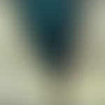 Keratosis follicularis spinulosa decalvans: Alopezie mit multiplen follikulären, nicht entzündlic...