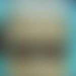 Keratosis follicularis spinulosa decalvans: Alopezie mit multiplen follikulären, nicht entzündlic...
