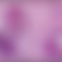 Keratosis follicularis spinulosa decalvans: Alopezie mit multiplen follikulären, nicht entzündlic...