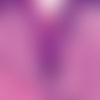 Phrynoderm:&nbsp;amphorenartig erweiterter proximaler Follikel der mit Hornmassen ausgefüllt ist....