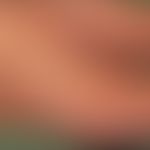 Porokeratotischer ekkriner Ostiumnaevus: streifenörmig konfigurierte keraotitsche Plaques (Blasch...