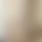 Nilotinib: erworbene Keratosi pilaris unter Theapie mit&nbsp;Nilotinib. Abb. entnommen aus:&nbsp;...