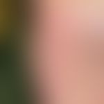 Erythema palmoplantare hereditarium : seit Geburt bestehendes völlig sympotmloses Erythem. Abbild...