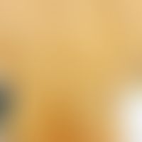 Elastolyse mediodermale: umschriebene, hier markierte flache, knittrige Propulsionen der Haut. Ab...