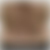 Elastolyse mediodermale: multiple, flache , sympotmlose, knittrige Propulsionen der Haut. Abb. en...