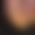 Onychogrypose:&nbsp;krallenartige&nbsp;Wuchsform der Fußnägel bei bekannter Psoriasis vulgaris. E...