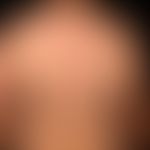 Pemphigus vulgaris:&nbsp;multiple, chronische, seit 3 Jahren schubweise verlaufende, symmetrische...