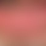 Pemphigus vulgaris: chronisch persistierende, flächenhafte, schmerzhafte Erosionen bei bekanntem ...