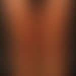 Neurofibrome: dermale und subkutane Neurofibrome bei bekanntem M. Recklinghausen.
