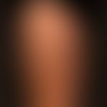 Neurofibrome: dermale und subkutane Neurofibrome bei bekanntem M. Recklinghausen.
