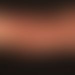 Dermatose IgA-lineare: frischer Schub einer vorbekannten,&nbsp;linearen IgA-Dermatose. Hier disse...