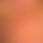Dermatose IgA-lineare:&nbsp;vorbekannte,&nbsp;&nbsp;lineare&nbsp;IgA-Dermatose. Hier gruppierte, ...