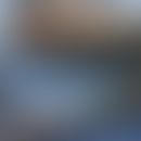 Anti-p200-Pemphigoid: Subepitheliale (kokardenförmige) Blasenbildungen bei einer 48-jährigen Pati...