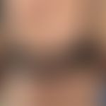 Differenzialdiagnose:&nbsp;Prurigo chronische

Diagnose: Prurigoform des bullösenPemphigoids. Abb...