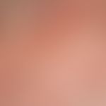 Lupus erythematodes chronicus discoides: zirkumskripte wenig gerötete Palques mit diffuser Alopez...