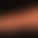 Extrinsische Hautalterung (chronischer Sonnenschaden): 64 Jahre alte Frau mit exzessiver Sonnenbe...