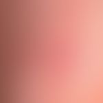 Differenzialdiagnose Pemphigoiderkrankungen -&nbsp;Diagnose:&nbsp;Lichen planus pemhigoides: 0,1-...