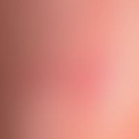 Differenzialdiagnose Pemphigoiderkrankungen -&nbsp;Diagnose:&nbsp;Lichen planus pemhigoides: 0,1-...