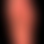 Differenziadliagnose: Dyshidrotische Dermatitis

Diagnose: Bullöses Pemphigoid der Fußsohle. Hier...