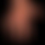 Dyshidrotische Dermatitis: ausgehend von einem längerzeitig besteheden,&nbsp;gramnegativen&nbsp;F...