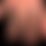 Dyshidrotische Dermatitis: ausgehend von einem längerzeitig besteheden,&nbsp;gramnegativen&nbsp;F...