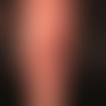 Prurigo nodularis: chronisch aktives, seit&nbsp;Jahren persistierendes&nbsp;Krankheitsbild. Gener...