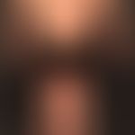 Prurigo nodularis: chronisch aktives, seit&nbsp;Jahren persistierendes&nbsp;Krankheitsbild. Gener...