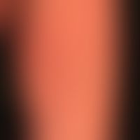 Erythema e calore: regelmäßige Anwendungen von Wärmekissen bei chronischem Friefren.&nbsp;&nbsp;U...