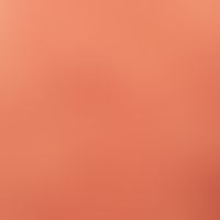 Erythema e calore: regelmäßige Anwendungen von Wärmekissen bei chronischem Friefren.&nbsp;&nbsp;U...