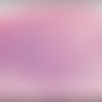 Lichenoide Dermatitis bei familiärem Lichen ruber actinicus. Abb. entnommen aus:&nbsp;Gökşin Ş et...