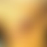 Mycobacterium genavense/Nichttuberkulöse Mykobakteriose:&nbsp;lymphangitische NTM bei HIV-Infekti...