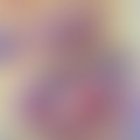 Mycobacterium lentiflavum: nosokomiale Infektion nach Lipolyse. Abb. entnommen aus:&nbsp;Mello RB...