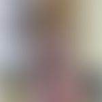 Mycobacterium intracellulare: granulomatöse "lupoide" Dermatitis mit groblamellärer Schuppung. Ab...