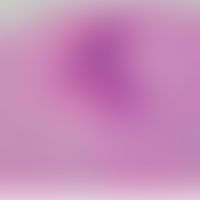 Elastosis perforans serpiginosa (HE):&nbsp;scholliges Material, das durch einen Follikel augeschl...