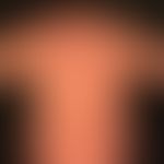 Differenzialdiagnose:&nbsp;Kollagenose reaktive perforierende

Diagnose: Chronische&nbsp;Prurigo
