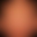 Pemphigoid gestationis:&nbsp;seit wenigen Tagen bestehende exanthematisch verteilte teils münzart...