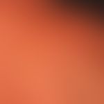 Chronische Lichtalterung der Haut: multiple unregelmäßig konfigurierte, Pigmentflecken unterschie...