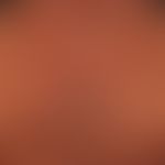 Chronische Lichtalterung der Haut: multiple unregelmäßig konfigurierte, Pigmentflecken unterschie...