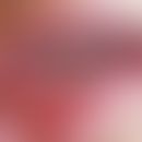 Aphthen habituelle: in regelmäßigen Zeitabständen auftretende flache weißlich Fibrin-bedeckte Sch...